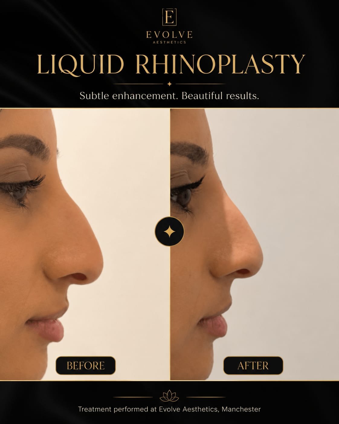 Before and after patient result
